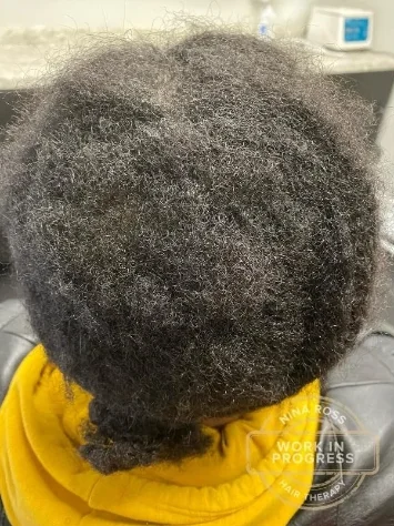 The same part after 28 weeks of treatment