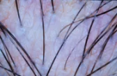 A client's scalp magnified 200 times