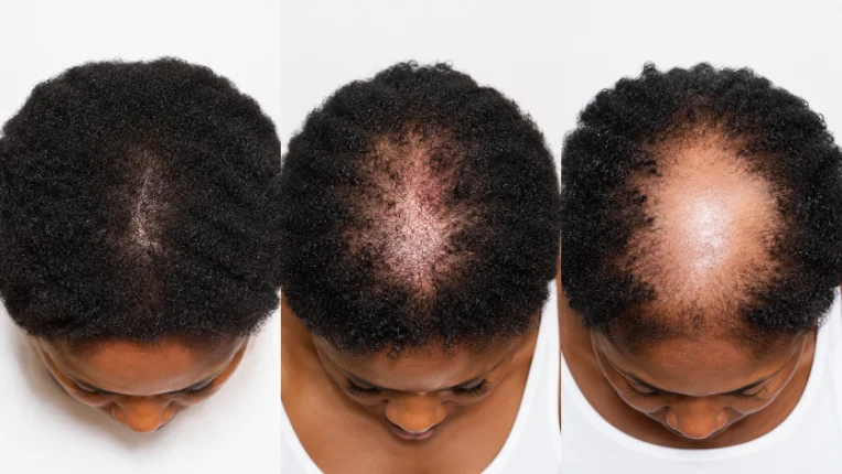 A 200x scalp reading displayed on screen